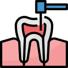 جزوه اندو (چرا دندان به درمان ریشه نیاز پیدا می کند؟)